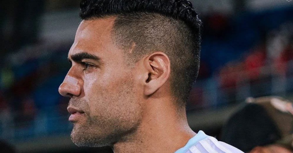 Millonarios confirma fractura en arco cigomático de Falcao tras golpe en partido contra América de Cali